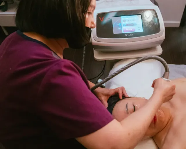V-MAX Lifting & Rejuvenation Treatment